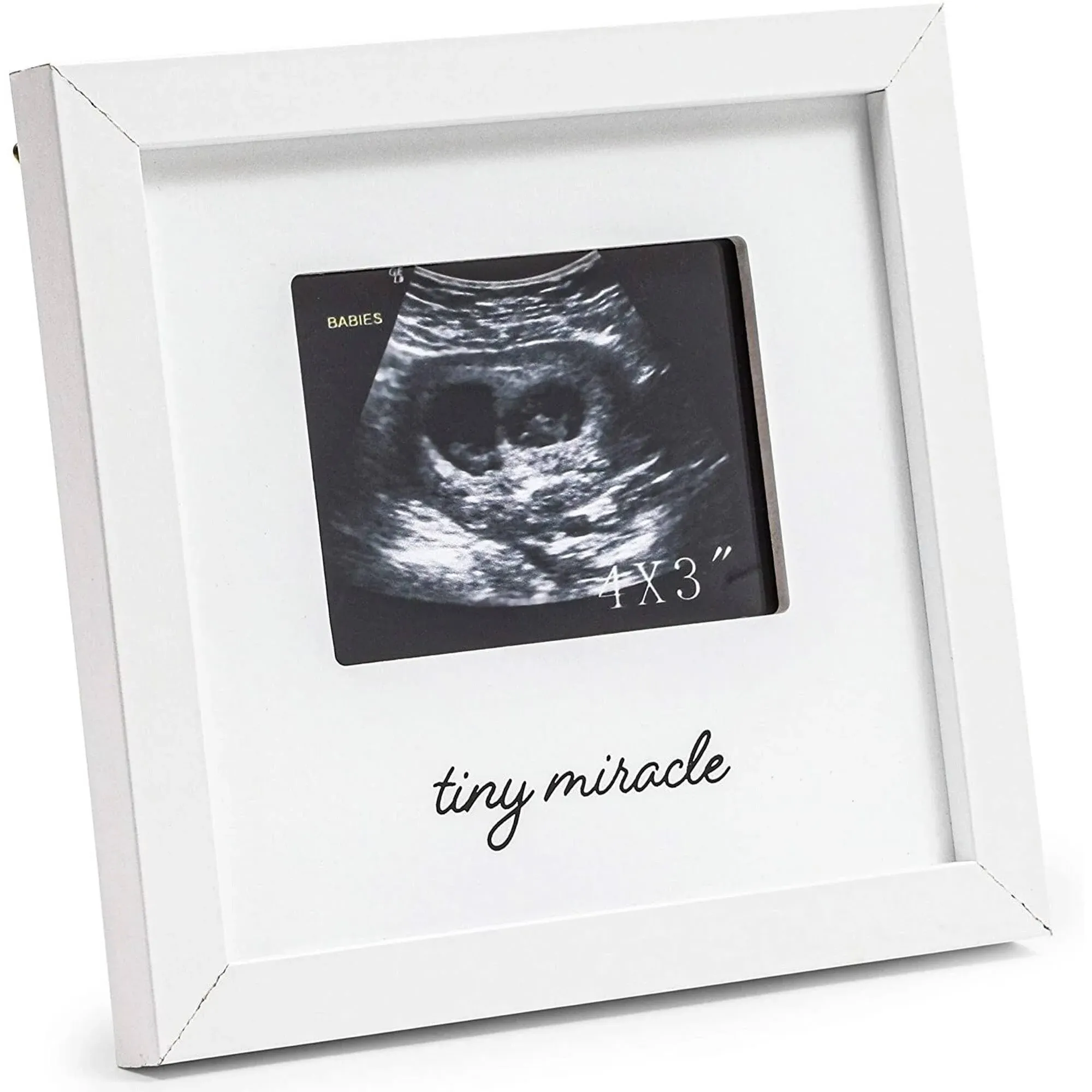 Juvale White Sonogram Keepsake Frame for 4 x 3 Ultrasound Photos (7 x 6.5 inches)